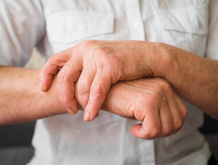 rheumatoid-arthritis