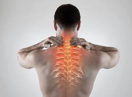 kebaikan-acupuncture-cervical-spondylosis 2