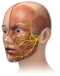 bell's palsy treatment'