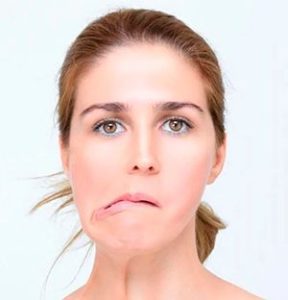facial paralysis