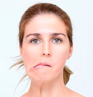 facial paralysis
