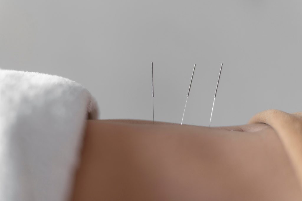 how-acupuncture-treat-for-menstrual-pain