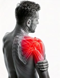 sakit-bahu-acupuncture