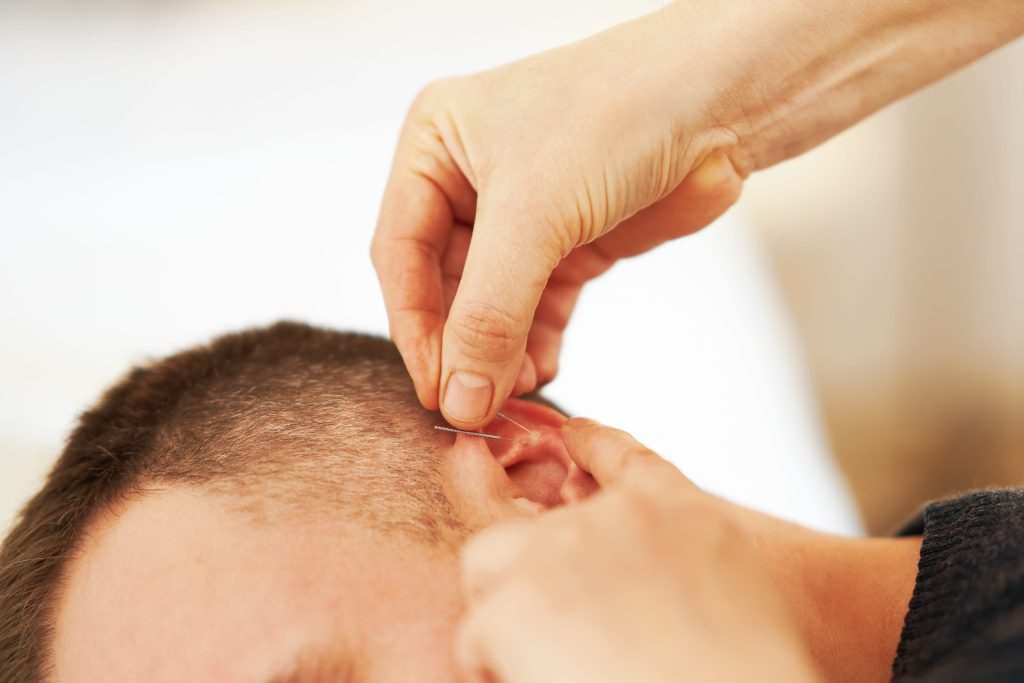 tinnitus-treatment-iswanah-acupuncture