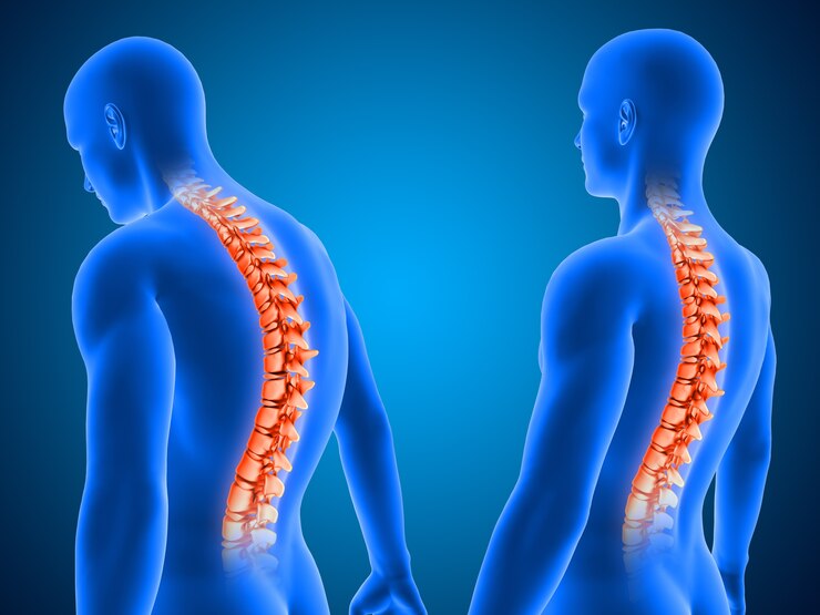 acupunture-for-slip-disc