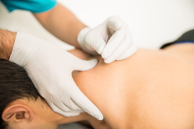 acupunture-for-slip-disc